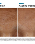 SkinCeuticals Hyaluronic Acid Intensifier Multi-Glycan + Geschenk P-TIOX - 15 ml