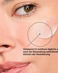 SkinCeuticals ADVANCED RGN-6