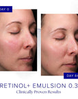 iS CLINICAL Retinol+ Emulsion 0.3
