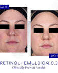 iS CLINICAL Retinol+ Emulsion 0.3
