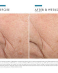 SkinCeuticals TRIPLE LIPID RESTORE 2:4:2
