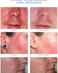 iS Clinical PRO HEAL SERUM ADVANCE+