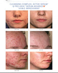 iS Clinical PRO HEAL SERUM ADVANCE+