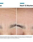 SkinCeuticals ADVANCED RGN-6