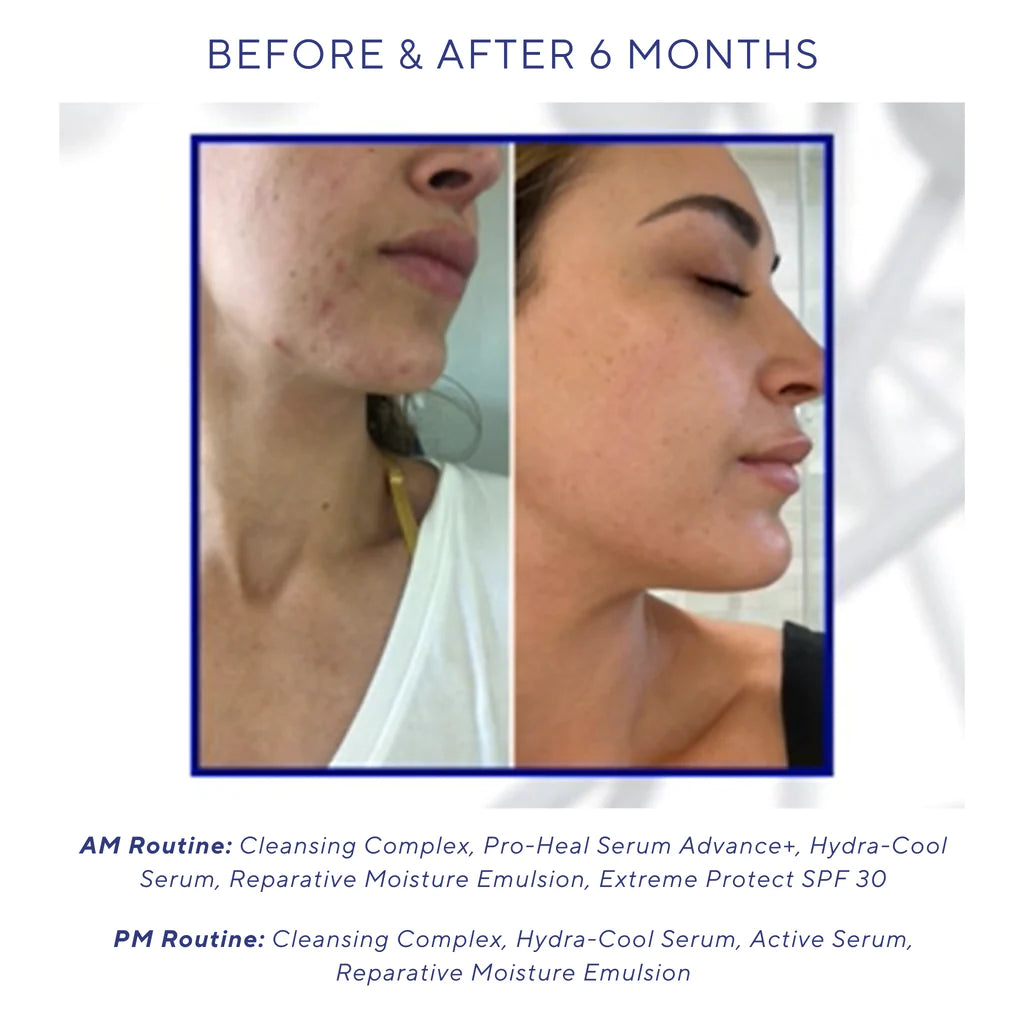iS Clinical HYDRA-COOL SERUM