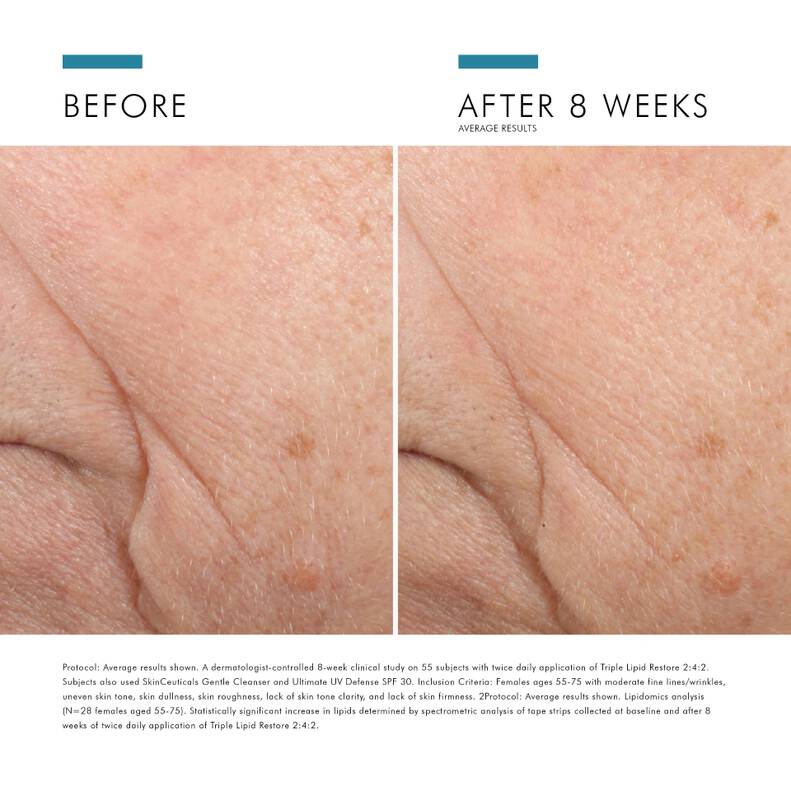 SkinCeuticals TRIPLE LIPID RESTORE 2:4:2