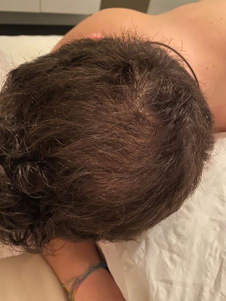 Dr. Niedermaier Regulatpro Hair Plus Kapseln & Serum SET