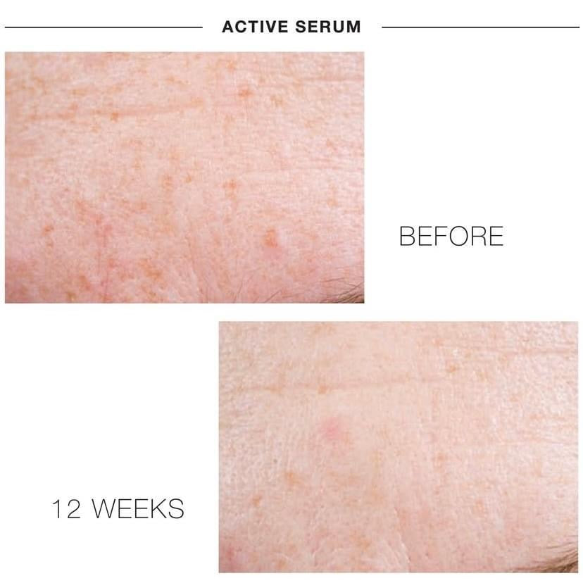 iS Clinical ACTIVE SERUM 15 ML / 30 ML