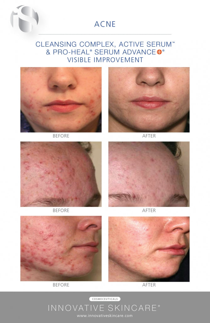 iS Clinical CLEANSING COMPLEX 60 ML / 180 ML