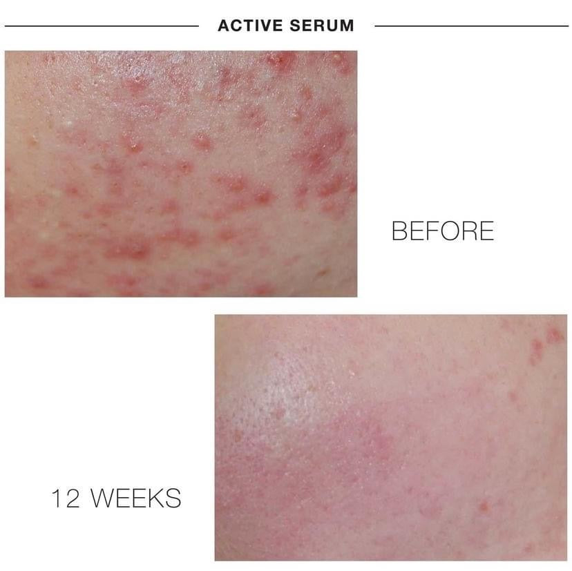 iS Clinical ACTIVE SERUM 15 ML / 30 ML