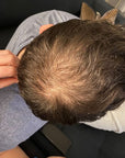 Dr. Niedermaier Regulatpro Hair Plus Kapseln & Serum SET